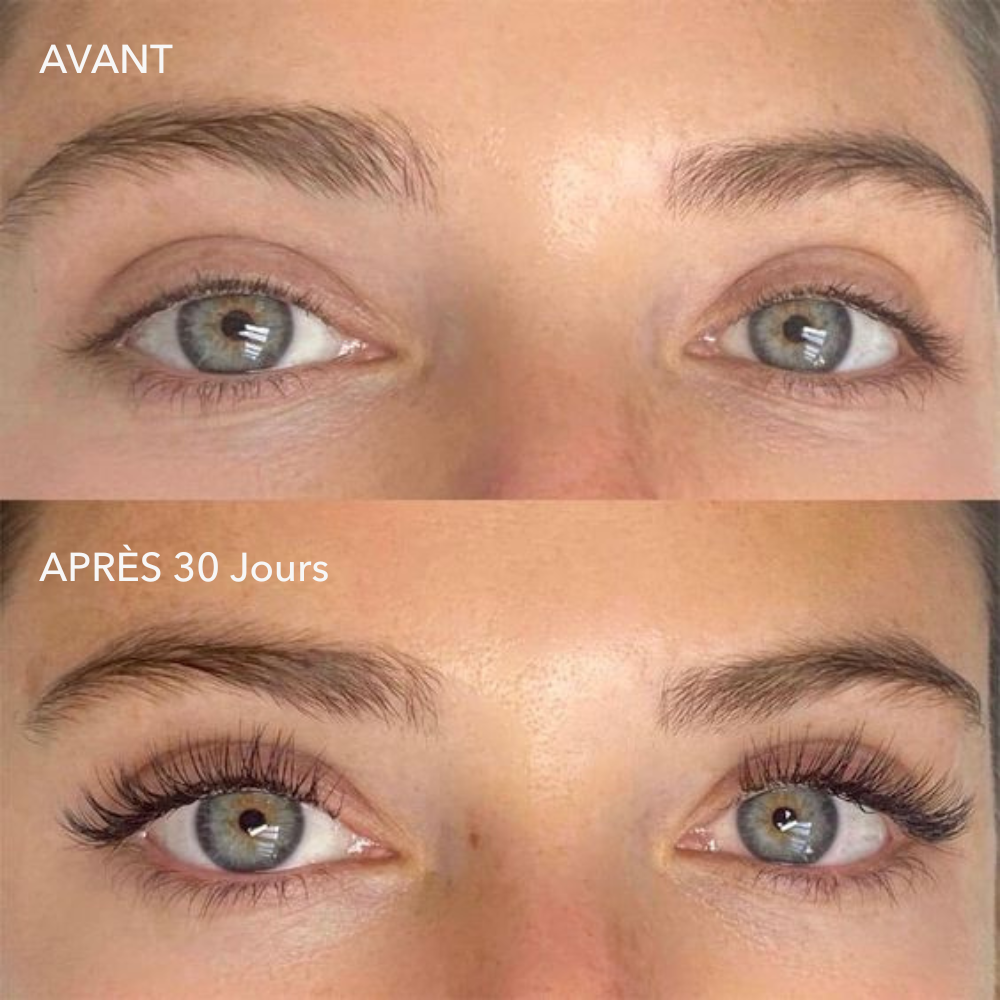 Sérum Révolutionnaire pour la Croissance des Cils - Offre Spéciale!