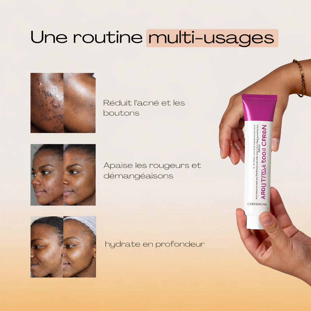 Crème Correcteur de Teint à l’Arbutine