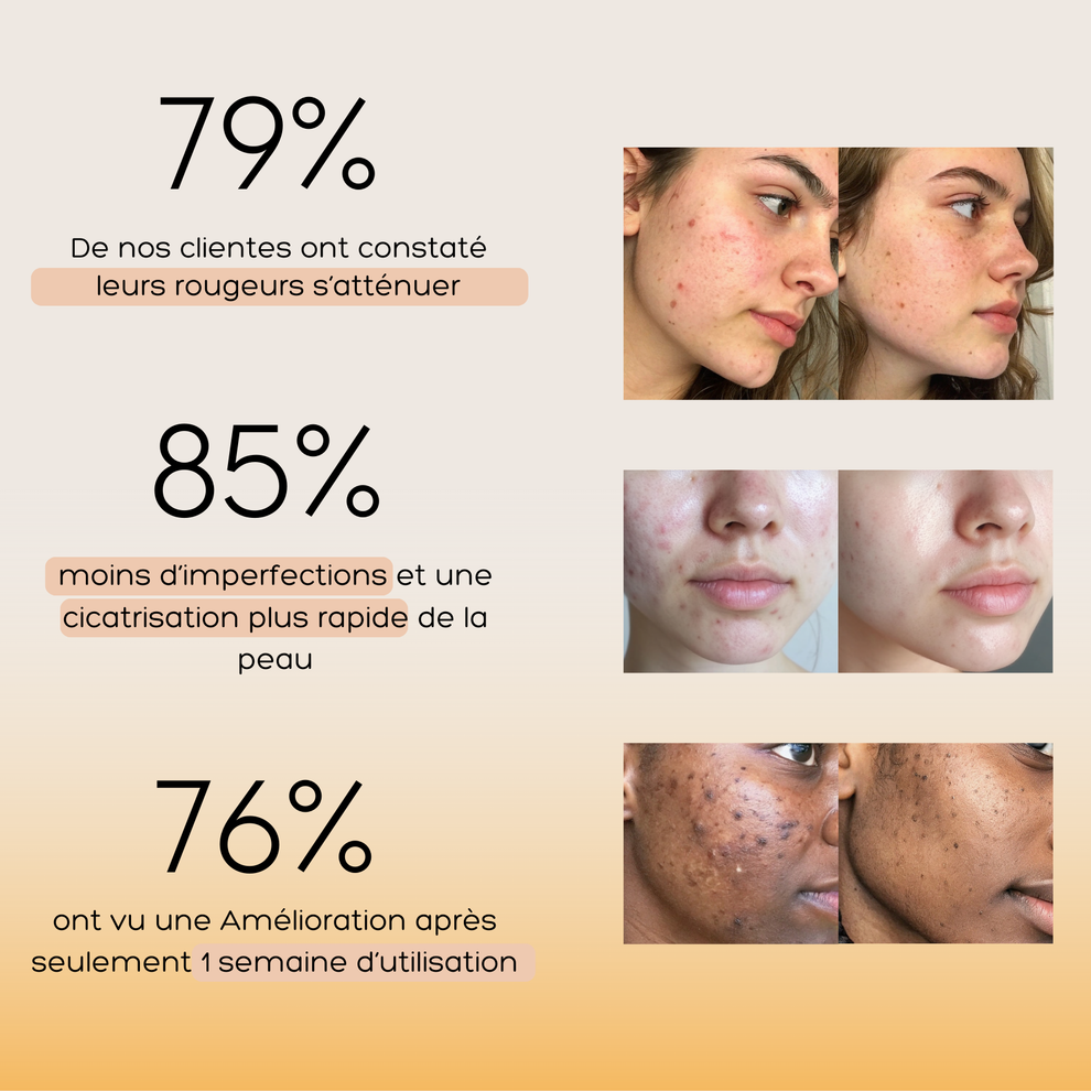 Crème Correcteur de Teint à l’Arbutine