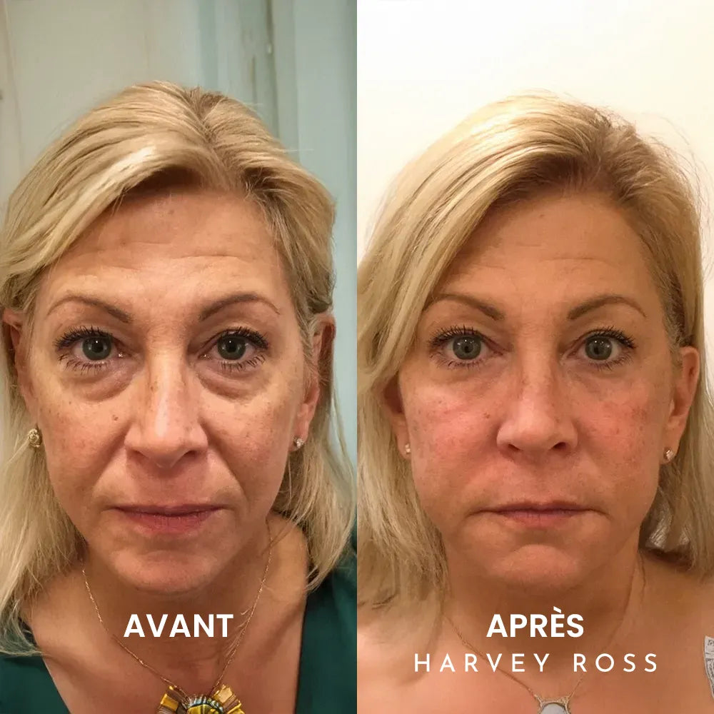 Crème Instant-Lift+