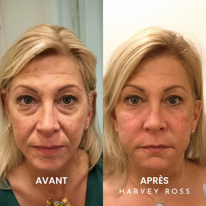 Crème Instant-Lift+