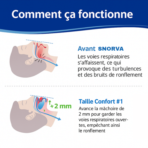 Embout Biccal Anti-ronflement médical discret et confortable