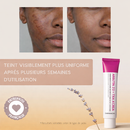 Crème Correcteur de Teint à l’Arbutine