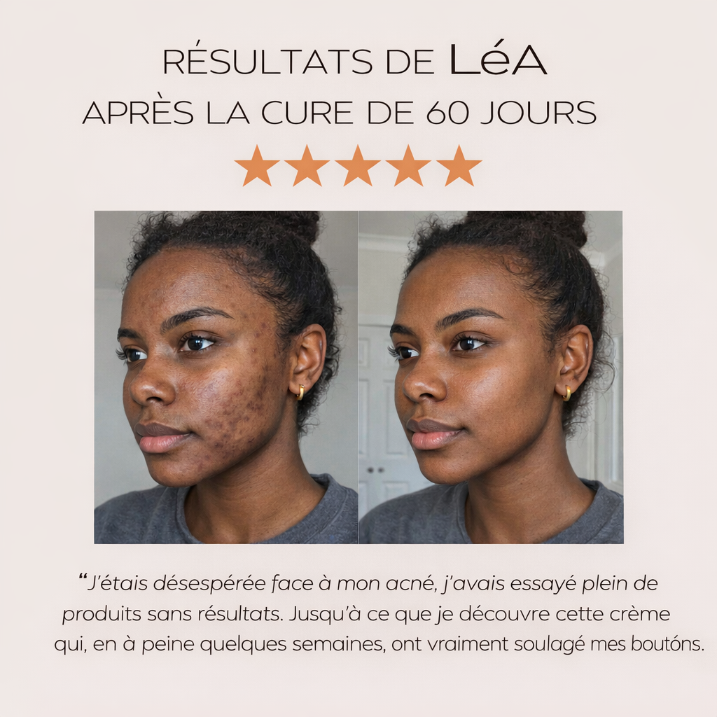 Crème Correcteur de Teint à l’Arbutine