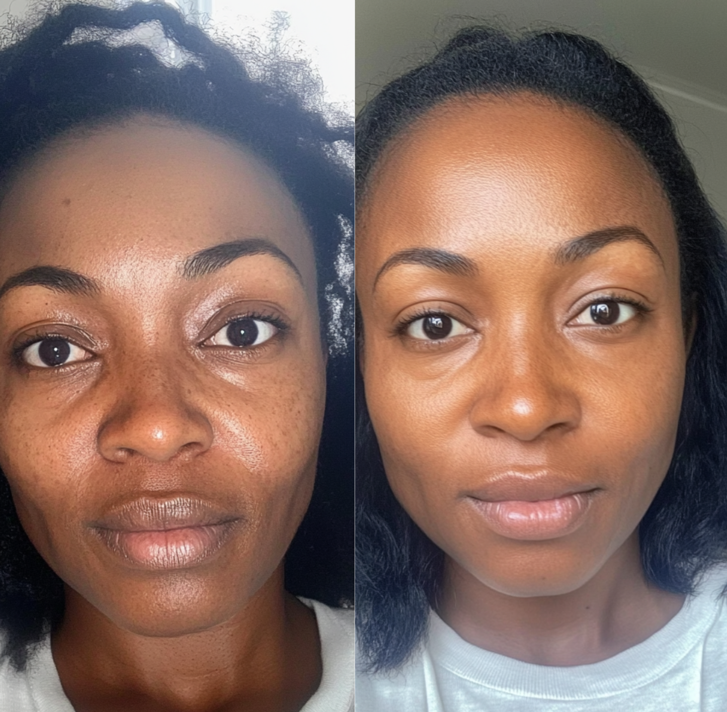 Mask au curcuma Anti-imperfection