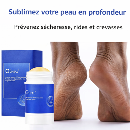 Baume Réparateur pour Pieds | 1 Acheté = 1 Chaussette Offert