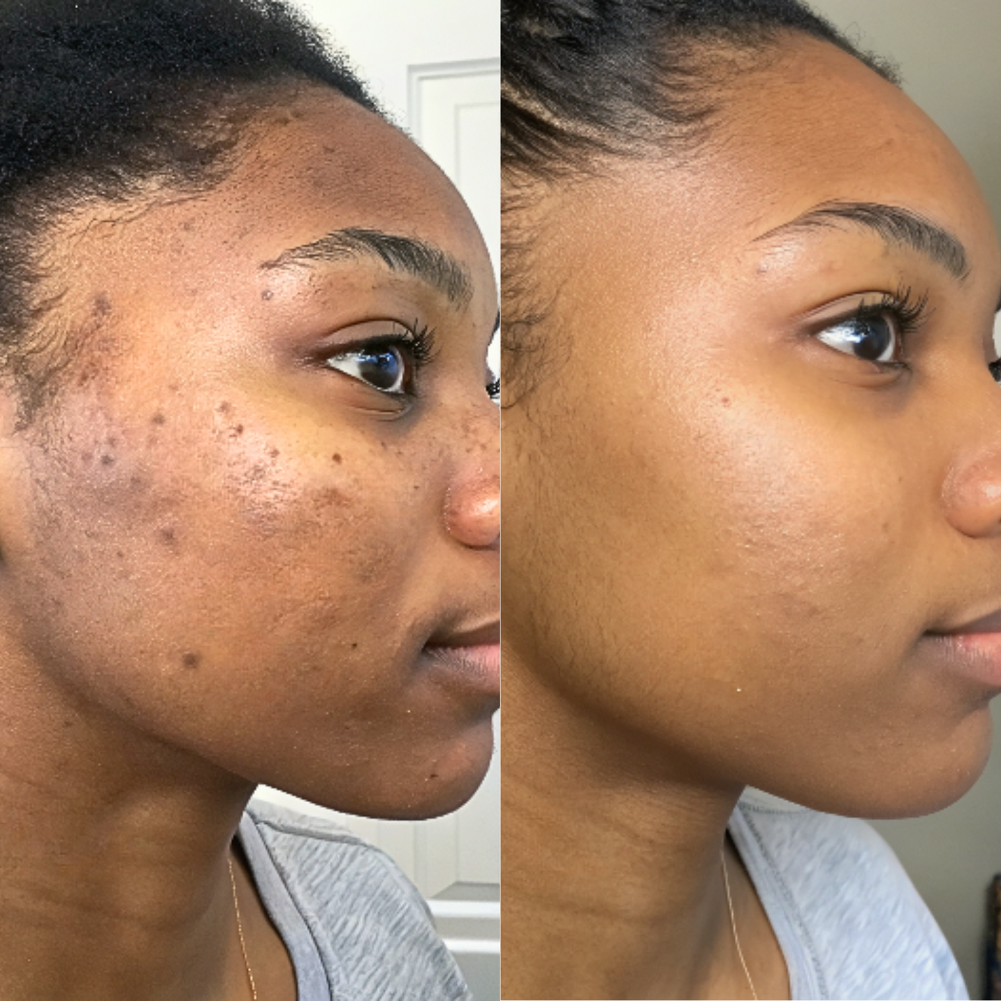 Mask au curcuma Anti-imperfection