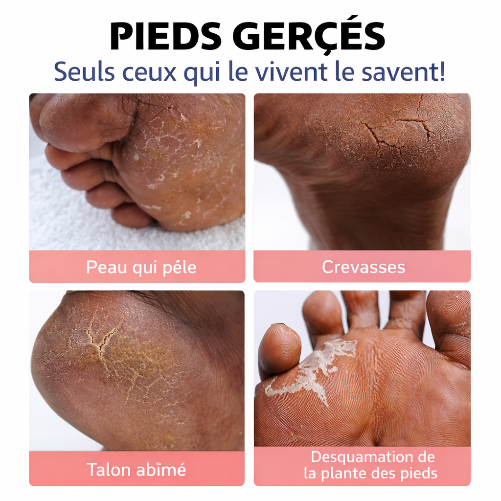 Baume Réparateur pour Pieds | 1 Acheté = 1 Chaussette Offert