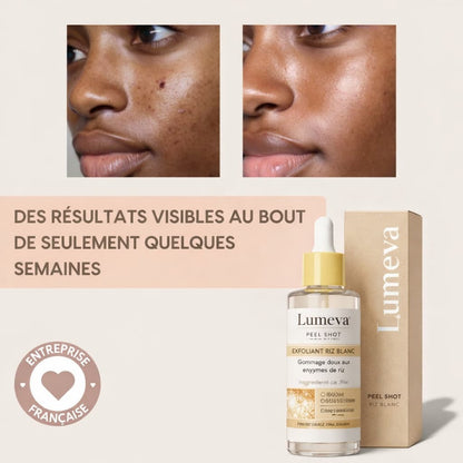 Peel Shot| Élimine les Impuretés et Sublime Votre Peau