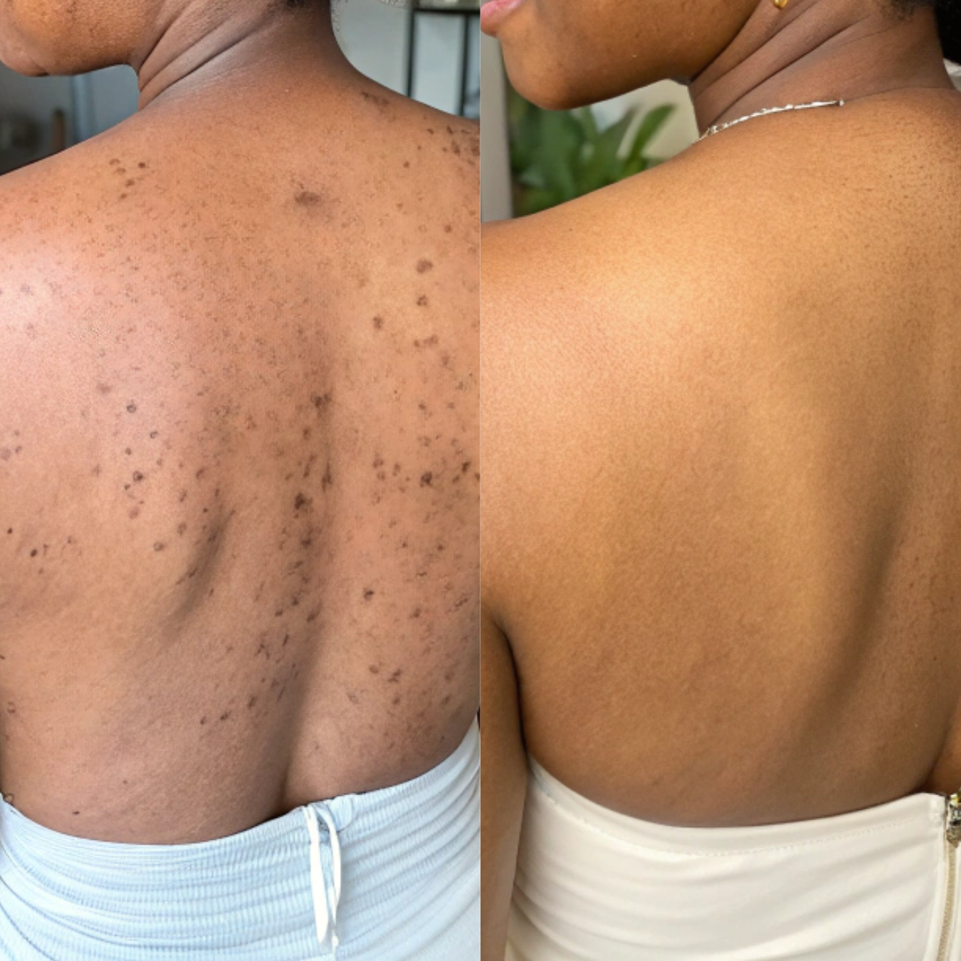 Beurre Corporel au Curcuma