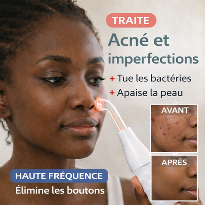 Baguette Haute Fréquence