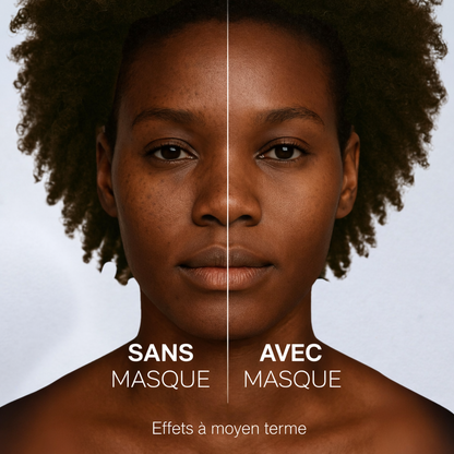 Mask au curcuma Anti-imperfection